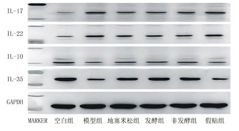 空白組和支氣管哮喘各組大鼠肺組織中IL－17、IL－22、IL－10、IL－35蛋白表達(dá)電泳圖
